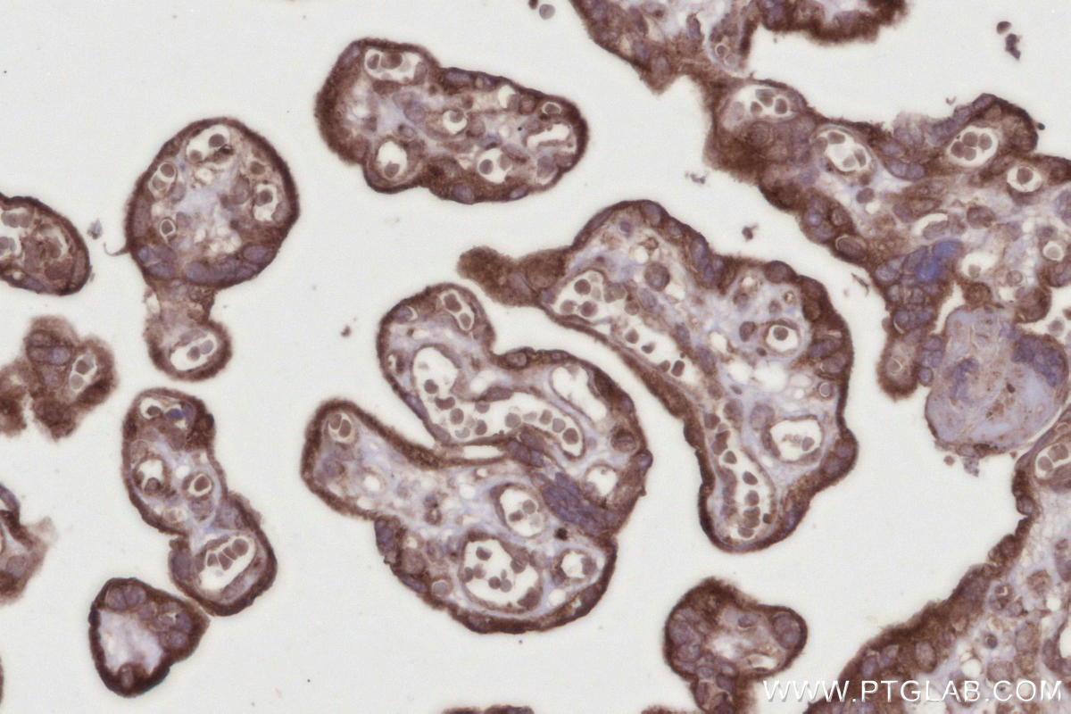 Immunohistochemical analysis of paraffin-embedded human placenta tissue slide using KHC2732 (RAB2B IHC Kit).