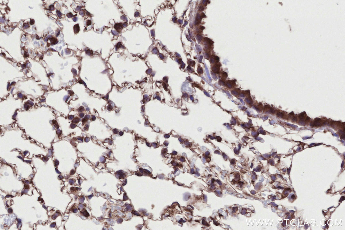 Immunohistochemical analysis of paraffin-embedded mouse lung tissue slide using KHC2732 (RAB2B IHC Kit).