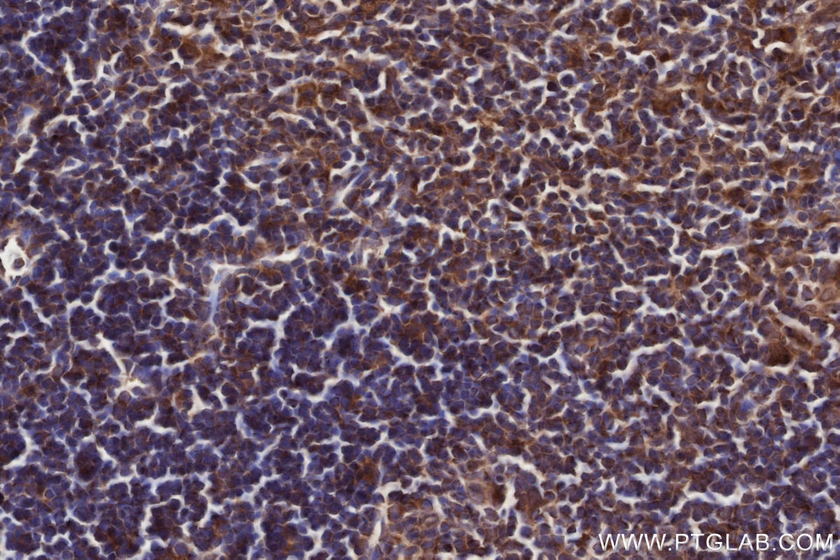 Immunohistochemical analysis of paraffin-embedded mouse thymus tissue slide using KHC2732 (RAB2B IHC Kit).