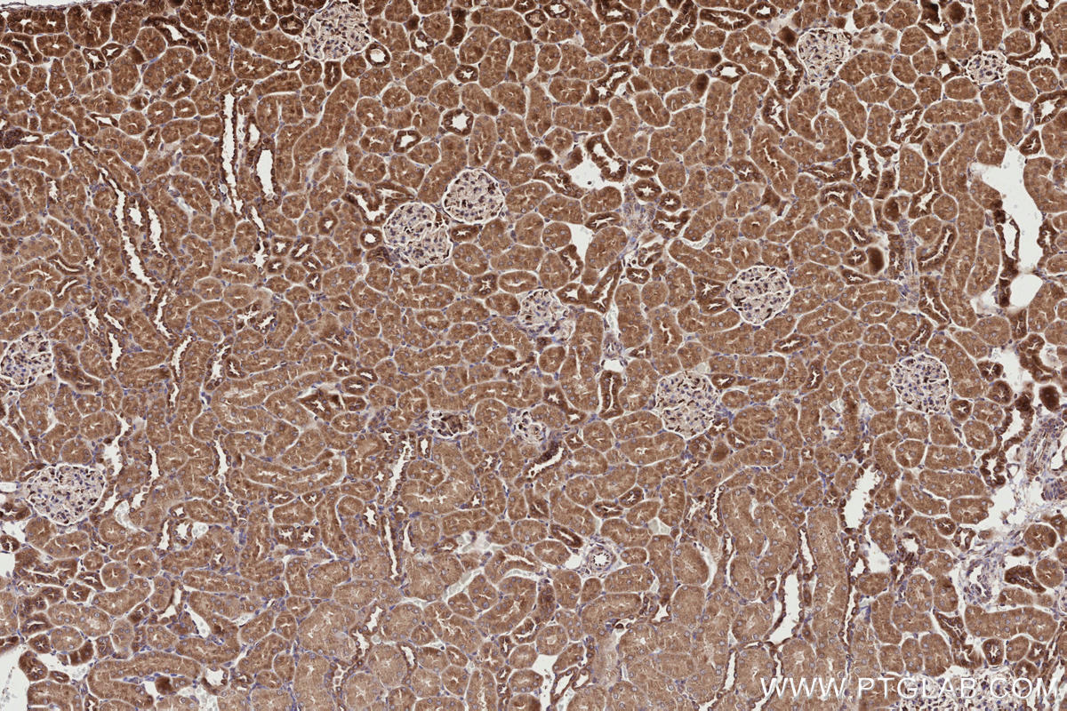 Immunohistochemical analysis of paraffin-embedded rat kidney tissue slide using KHC2732 (RAB2B IHC Kit).