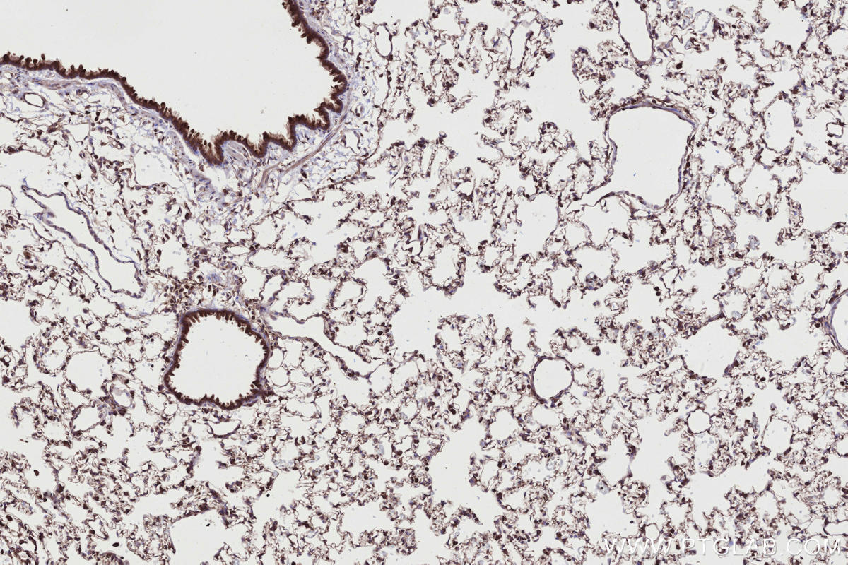 Immunohistochemical analysis of paraffin-embedded rat lung tissue slide using KHC2732 (RAB2B IHC Kit).