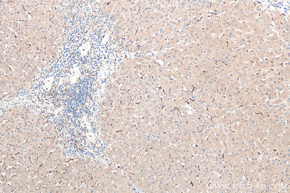 Immunohistochemical analysis of paraffin-embedded human liver tissue slide using KHC0451 (RAB32 IHC Kit).