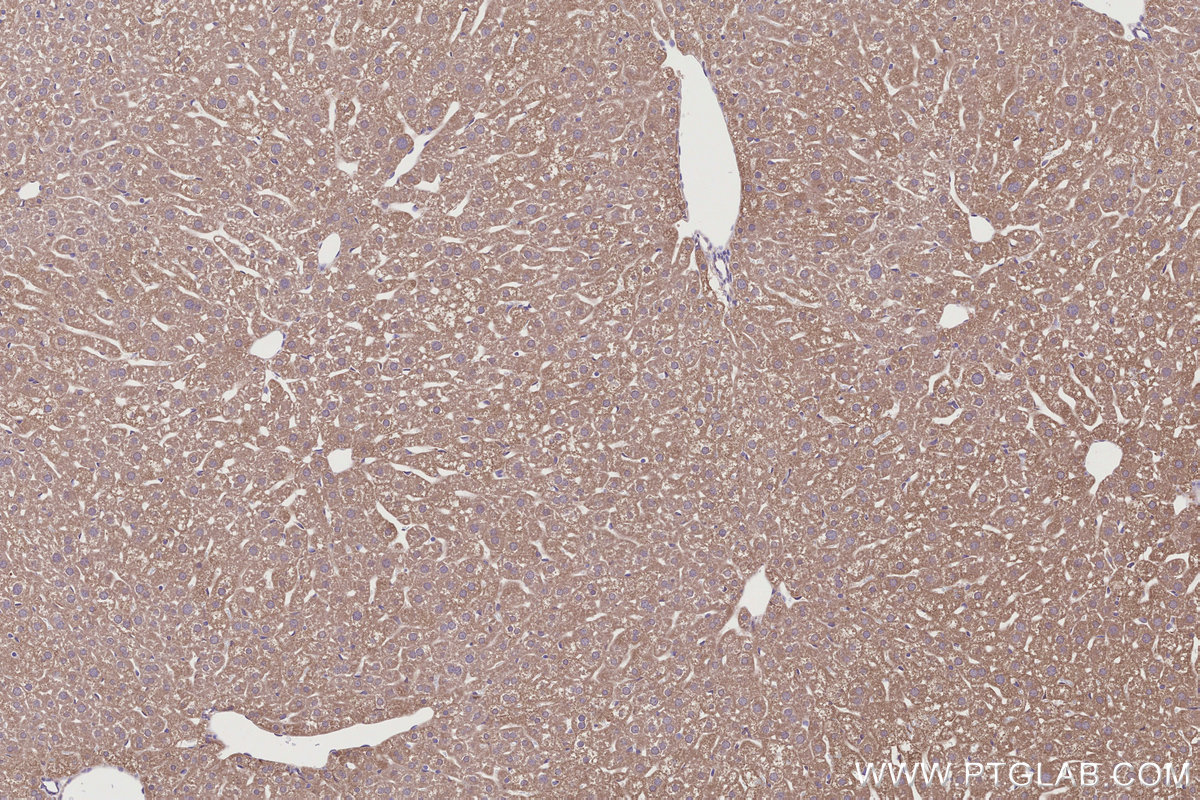 Immunohistochemical analysis of paraffin-embedded mouse liver tissue slide using KHC2785 (RAB39B IHC Kit).