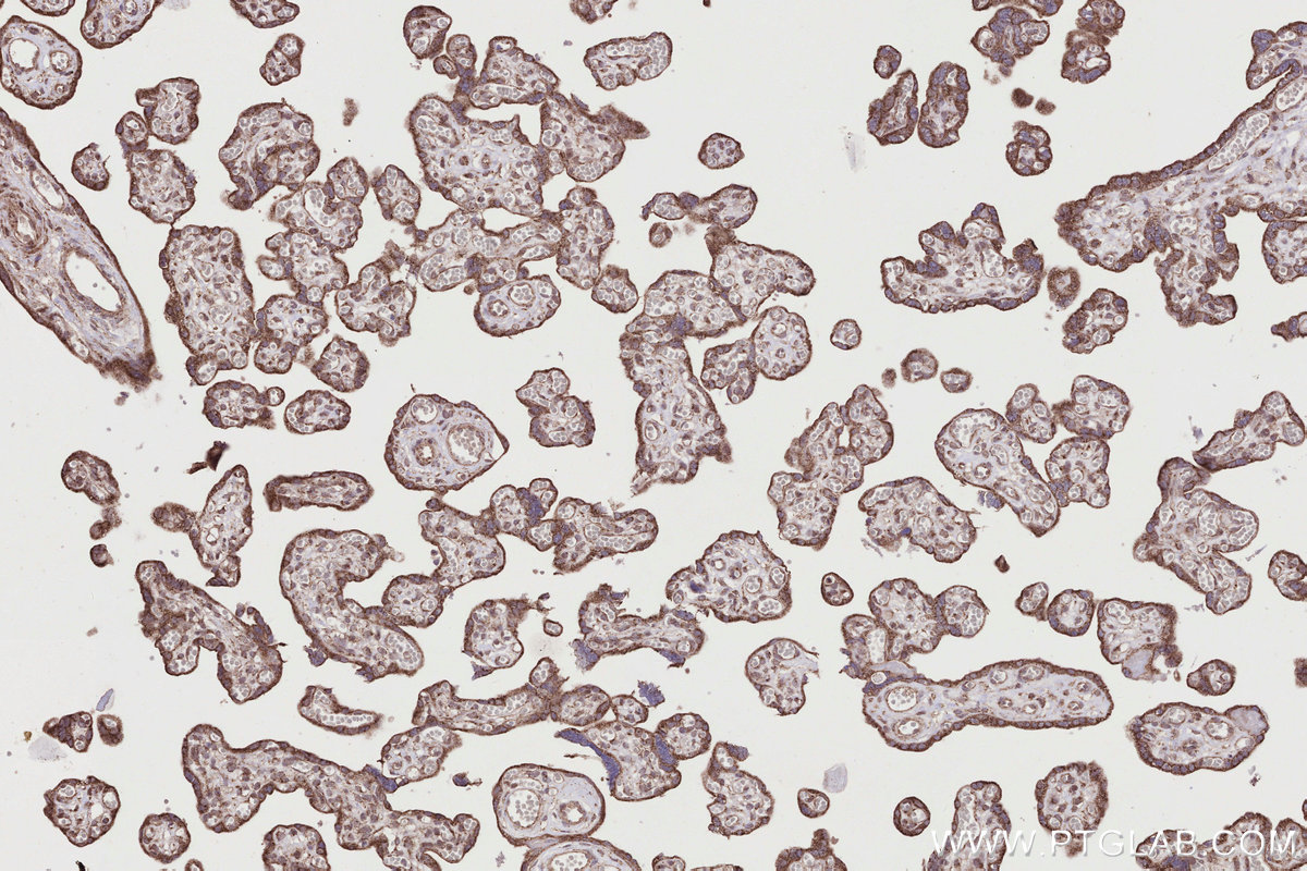 Immunohistochemical analysis of paraffin-embedded human placenta tissue slide using KHC2785 (RAB39B IHC Kit).