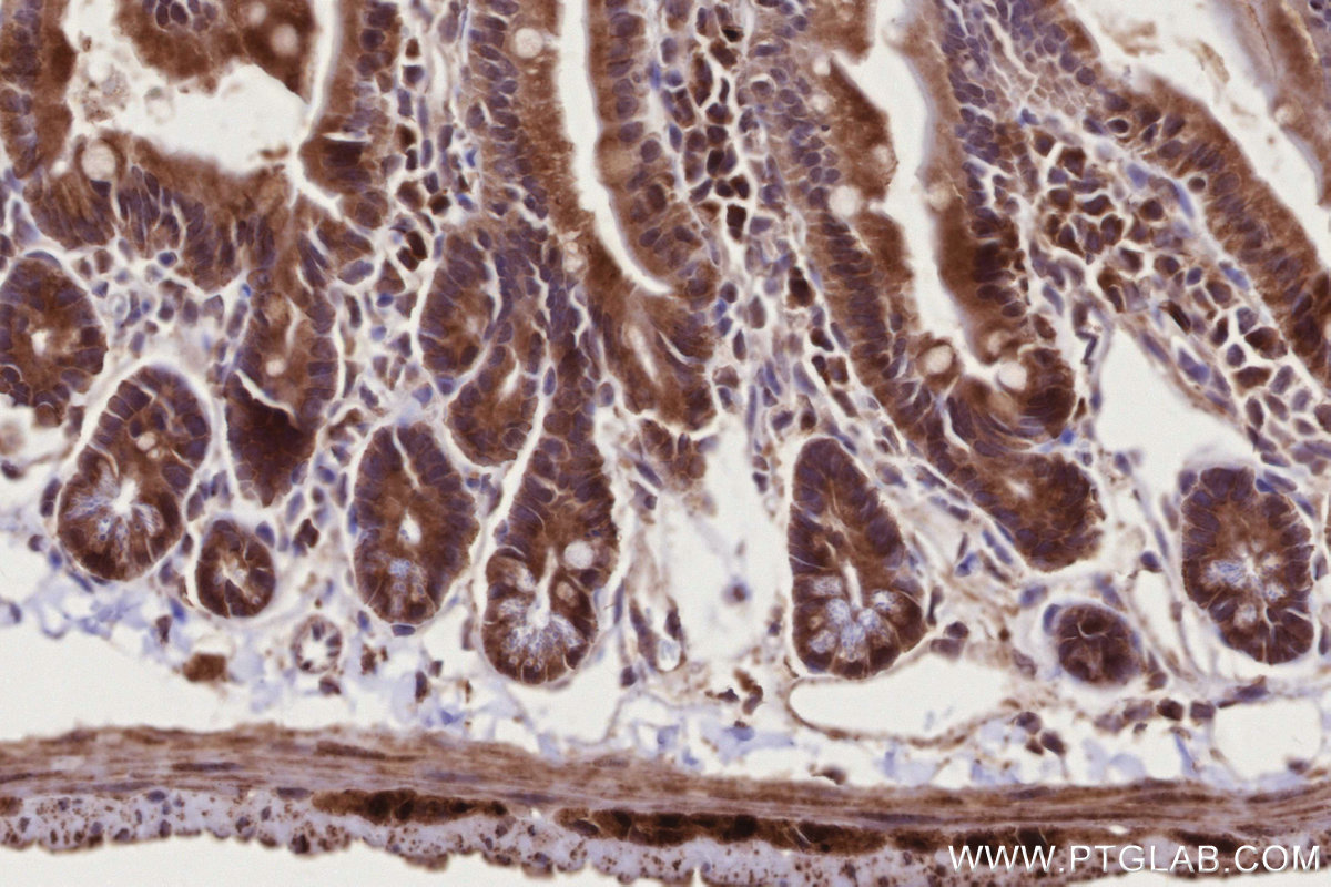 Immunohistochemical analysis of paraffin-embedded mouse small intestine tissue slide using KHC2785 (RAB39B IHC Kit).