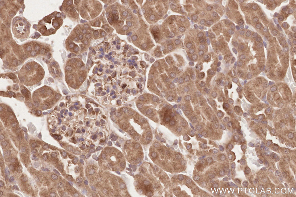 Immunohistochemical analysis of paraffin-embedded mouse kidney tissue slide using KHC2640 (RAB43 IHC Kit).