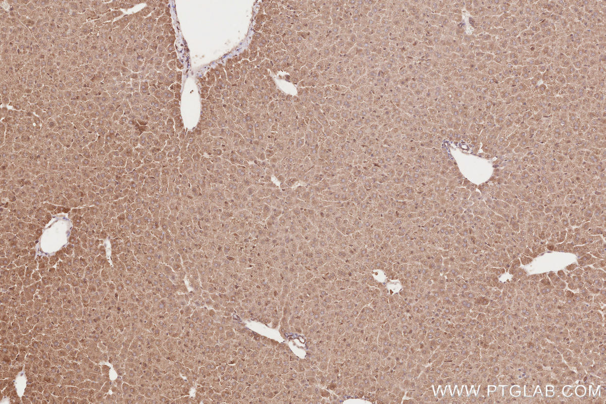 Immunohistochemical analysis of paraffin-embedded mouse liver tissue slide using KHC2640 (RAB43 IHC Kit).