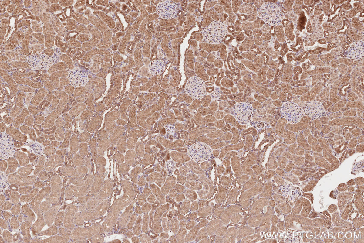 Immunohistochemical analysis of paraffin-embedded rat kidney tissue slide using KHC2640 (RAB43 IHC Kit).