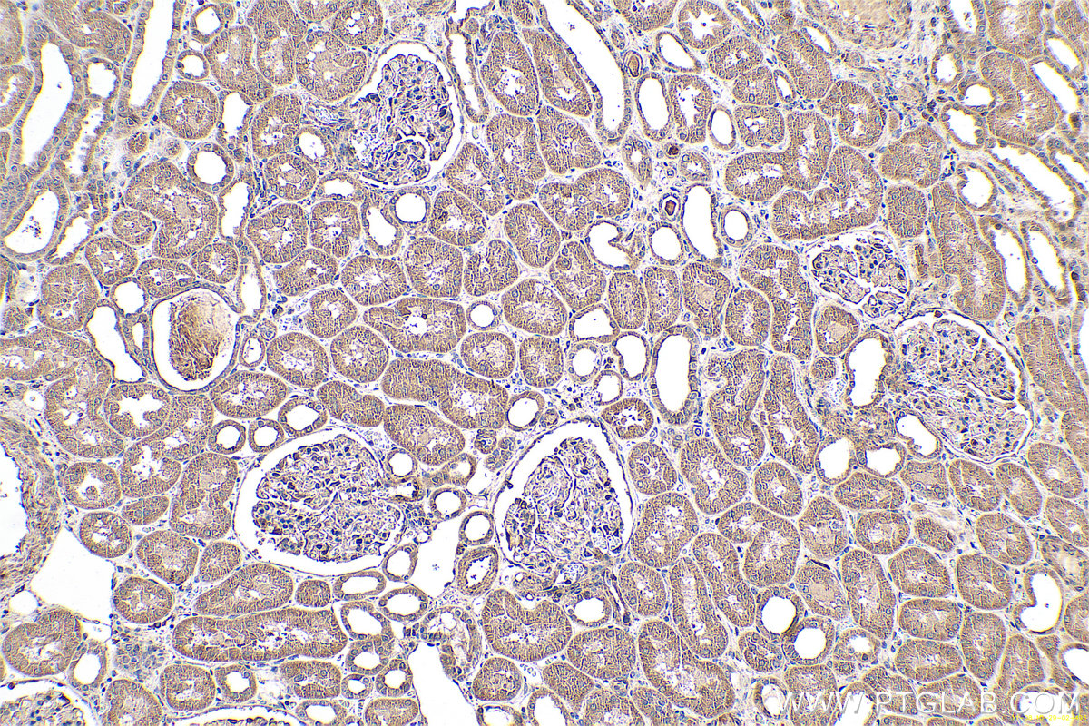 Immunohistochemical analysis of paraffin-embedded human kidney tissue slide using KHC0700 (RAB7A IHC Kit).