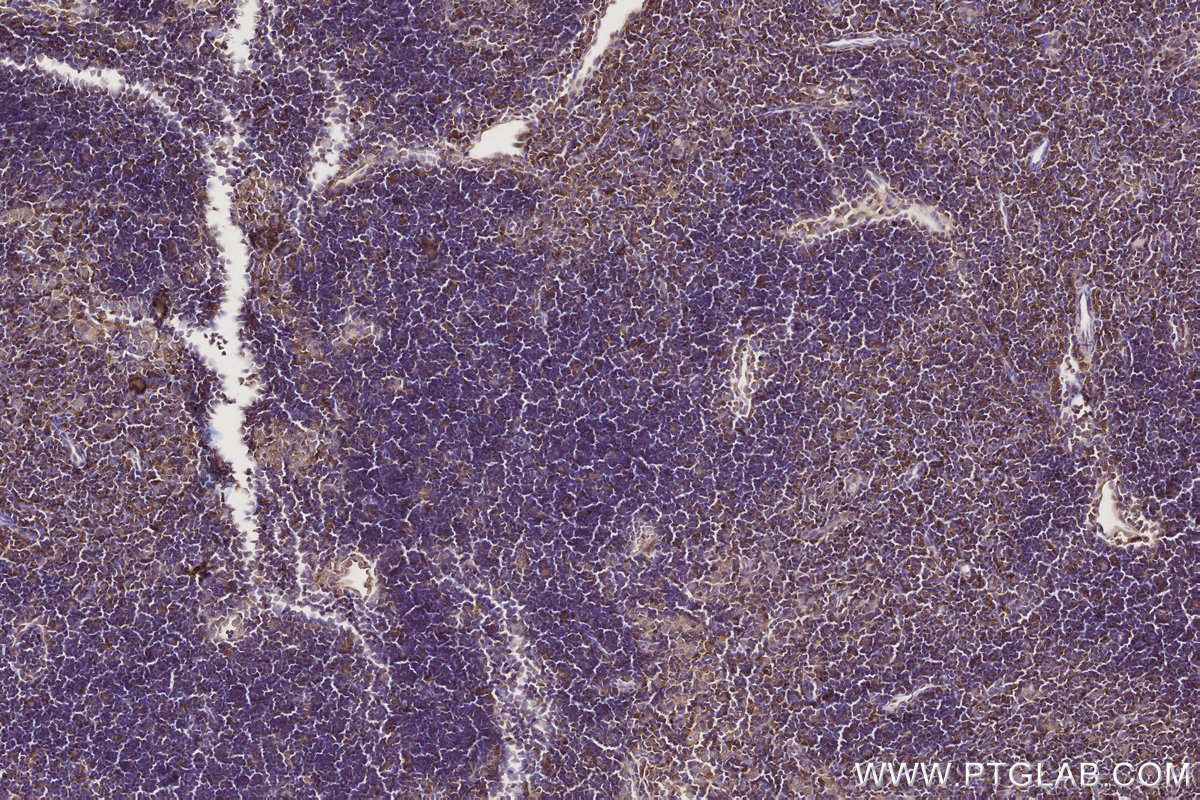 Immunohistochemical analysis of paraffin-embedded mouse thymus tissue slide using KHC2766 (RAB8 IHC Kit).