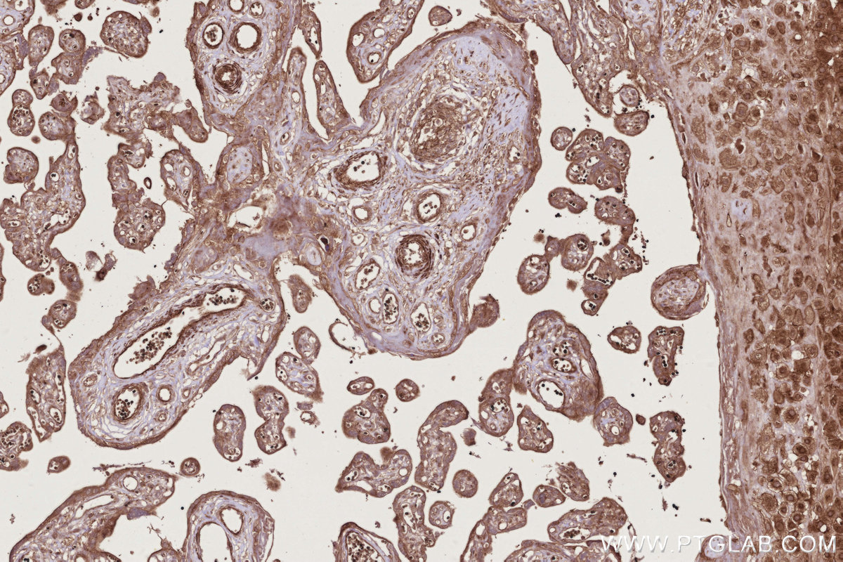 Immunohistochemical analysis of paraffin-embedded human placenta tissue slide using KHC2766 (RAB8 IHC Kit).