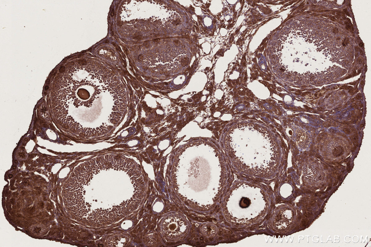 Immunohistochemical analysis of paraffin-embedded mouse ovary tissue slide using KHC2766 (RAB8 IHC Kit).