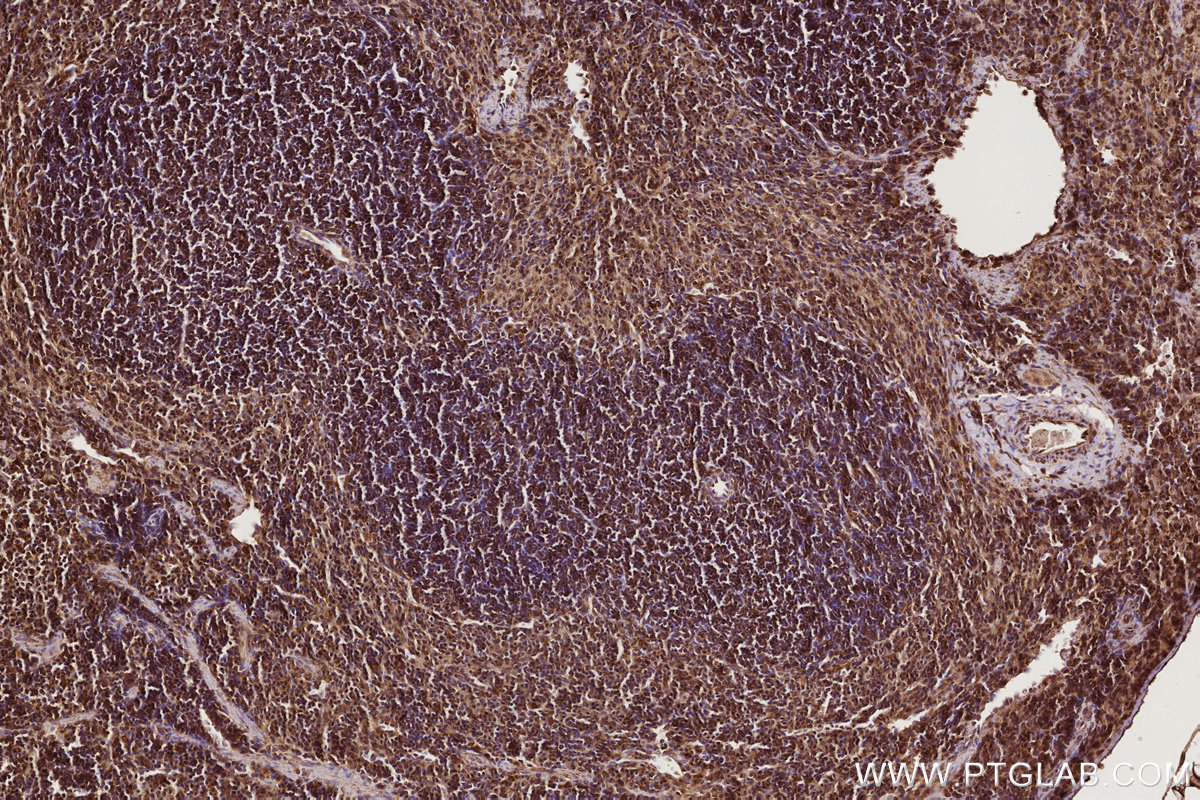 Immunohistochemical analysis of paraffin-embedded mouse spleen tissue slide using KHC2766 (RAB8 IHC Kit).