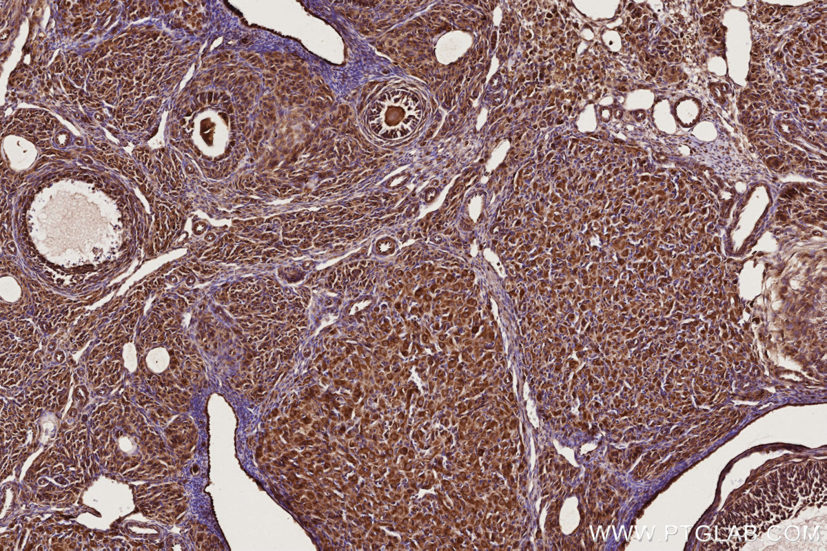 Immunohistochemical analysis of paraffin-embedded rat ovary tissue slide using KHC2766 (RAB8 IHC Kit).