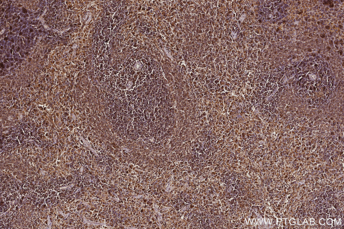 Immunohistochemical analysis of paraffin-embedded rat spleen tissue slide using KHC2766 (RAB8 IHC Kit).