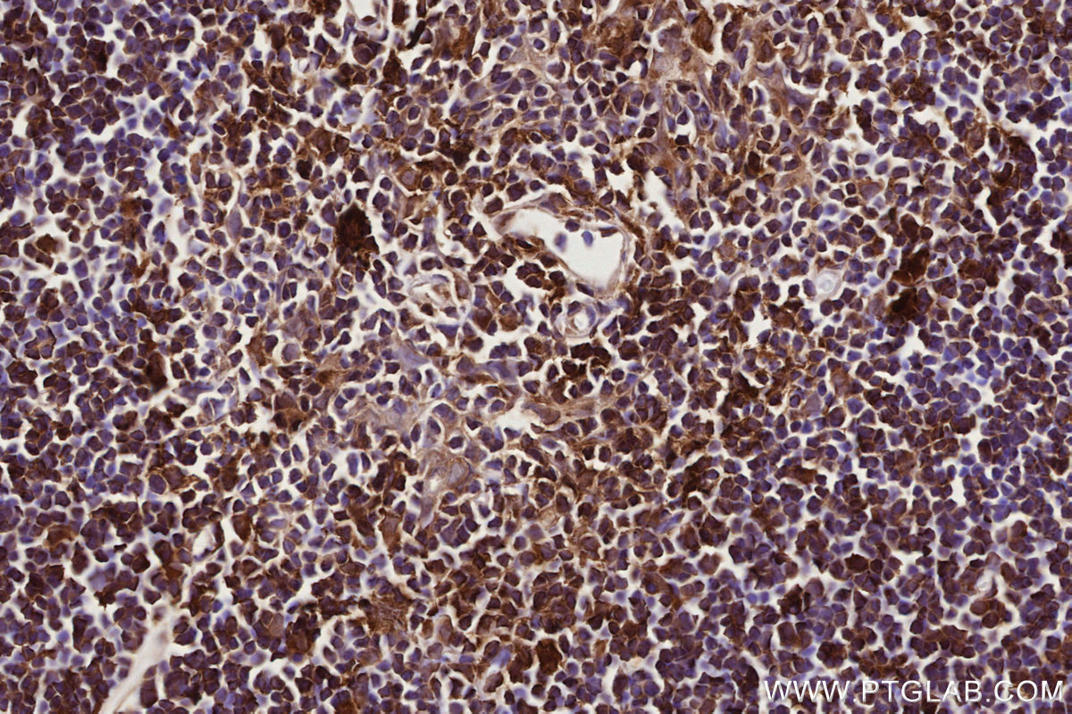 Immunohistochemical analysis of paraffin-embedded rat thymus tissue slide using KHC2766 (RAB8 IHC Kit).