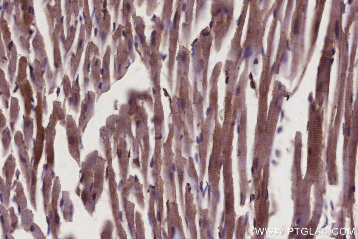 Immunohistochemical analysis of paraffin-embedded mouse heart tissue slide using KHC2936 (RAB9B IHC Kit).