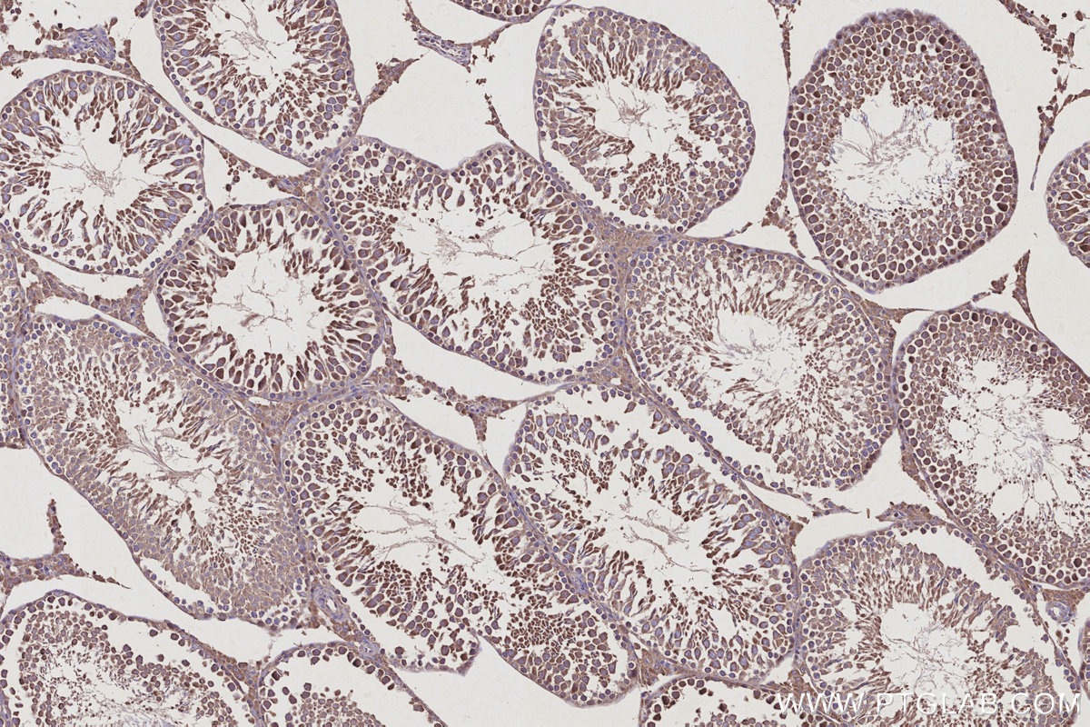 Immunohistochemical analysis of paraffin-embedded rat testis tissue slide using KHC2936 (RAB9B IHC Kit).