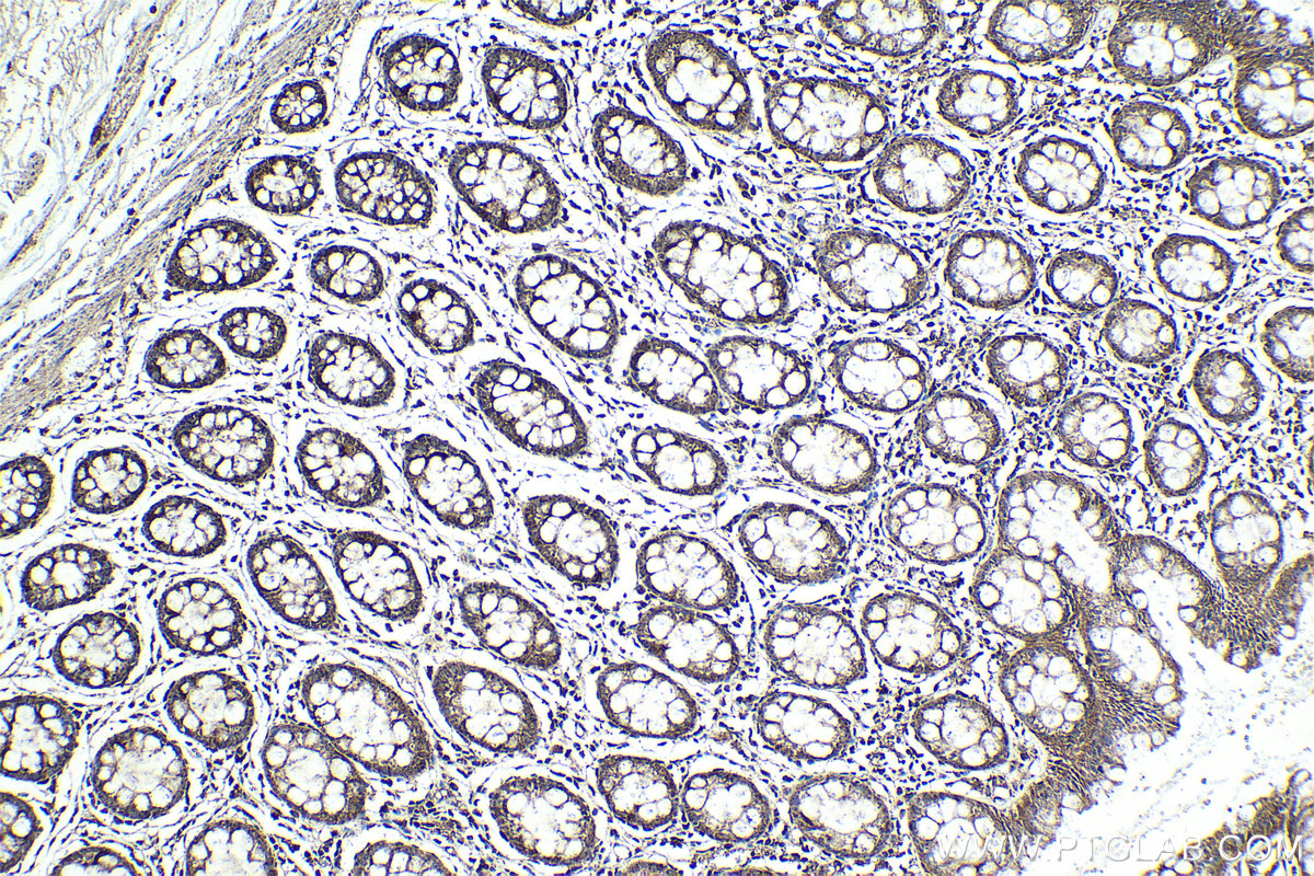 Immunohistochemical analysis of paraffin-embedded human colon tissue slide using KHC0992 (RABEPK IHC Kit).