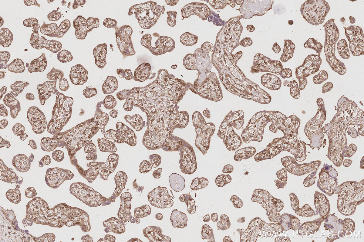 Immunohistochemical analysis of paraffin-embedded human placenta tissue slide using KHC3066 (RABGAP1 IHC Kit).