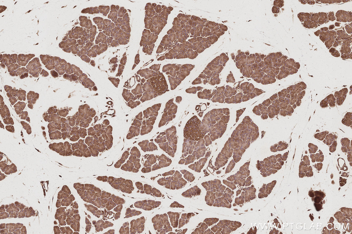 Immunohistochemical analysis of paraffin-embedded rat pancreas tissue slide using KHC3066 (RABGAP1 IHC Kit).