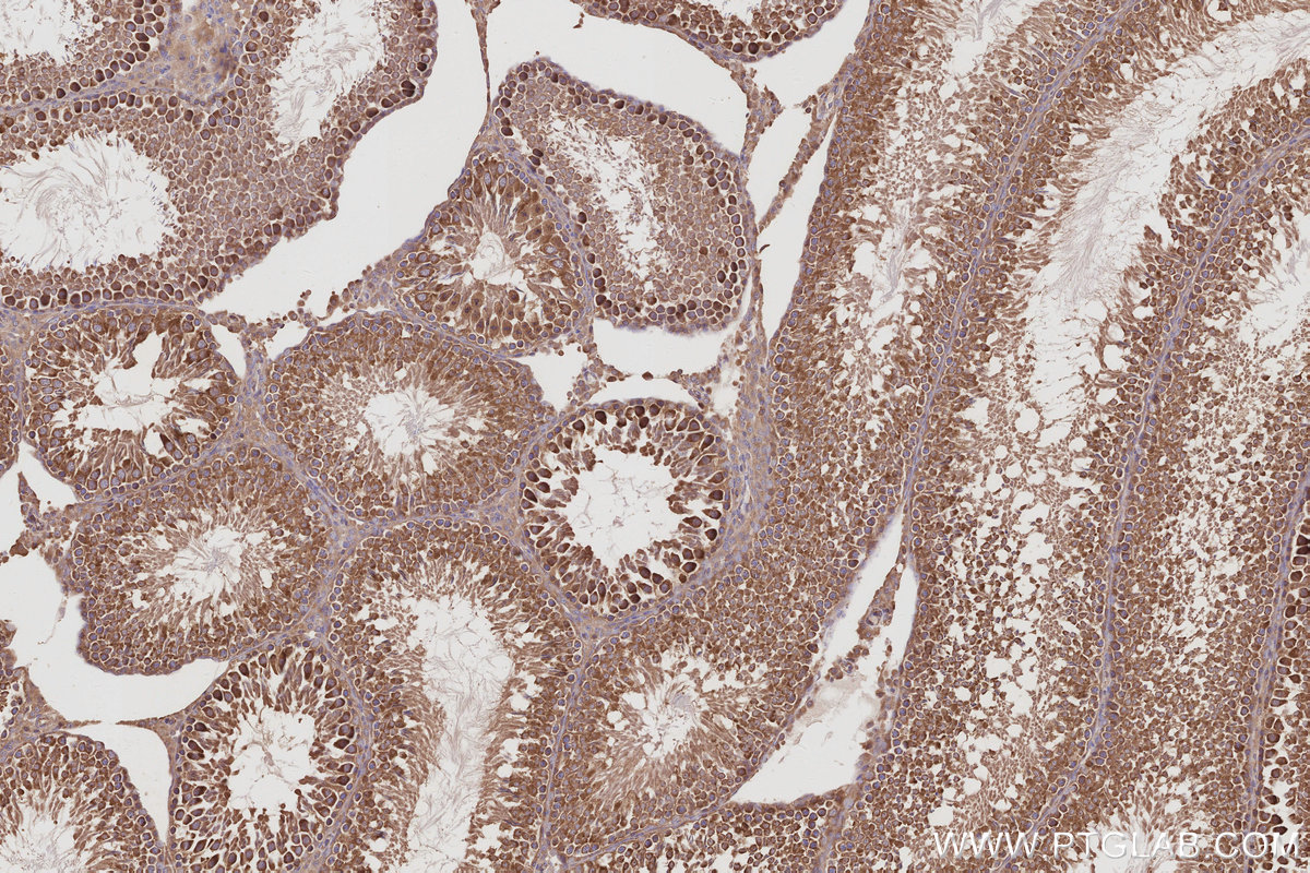 Immunohistochemical analysis of paraffin-embedded rat testis tissue slide using KHC3066 (RABGAP1 IHC Kit).