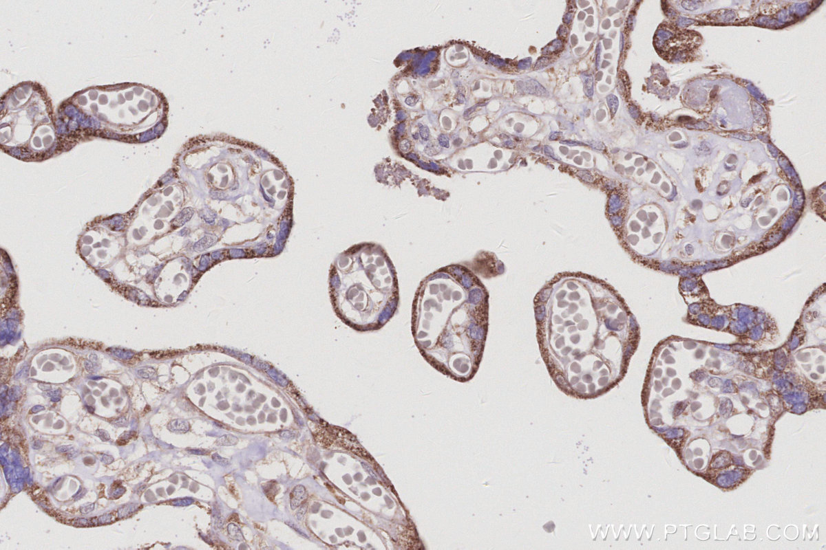 Immunohistochemical analysis of paraffin-embedded human placenta tissue slide using KHC3015 (RABGEF1 IHC Kit). Immunohistochemical analysis of paraffin-embedded human placenta tissue slide using KHC3015 (RABGEF1 IHC Kit).