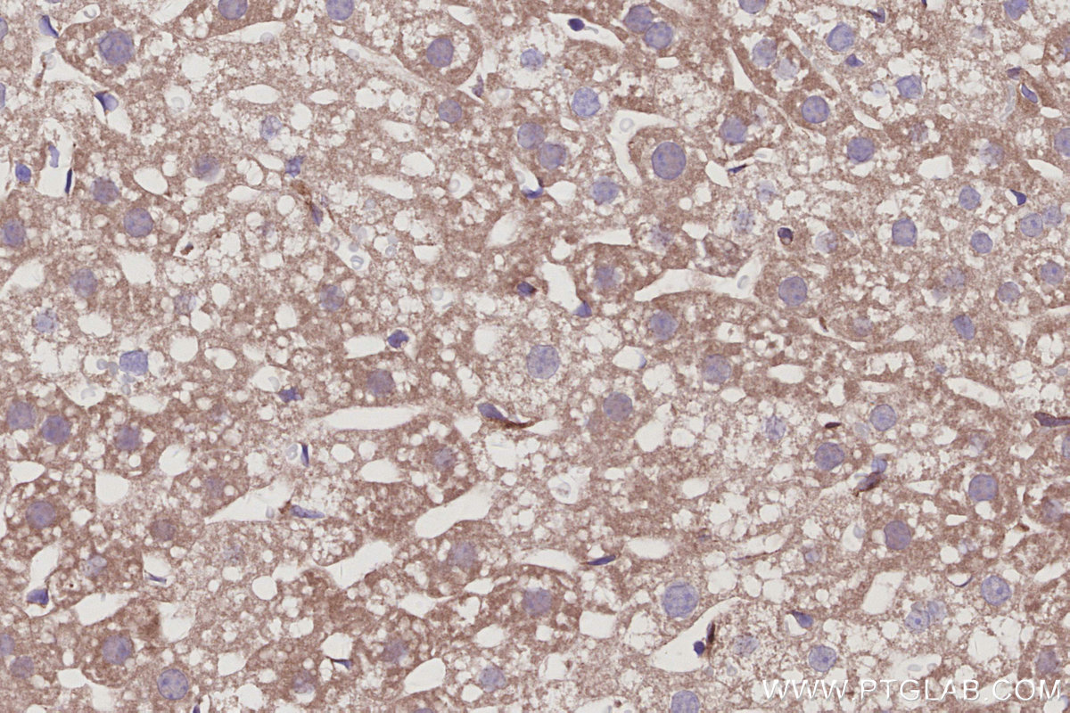 Immunohistochemical analysis of paraffin-embedded mouse liver tissue slide using KHC3015 (RABGEF1 IHC Kit). Immunohistochemical analysis of paraffin-embedded mouse liver tissue slide using KHC3015 (RABGEF1 IHC Kit).