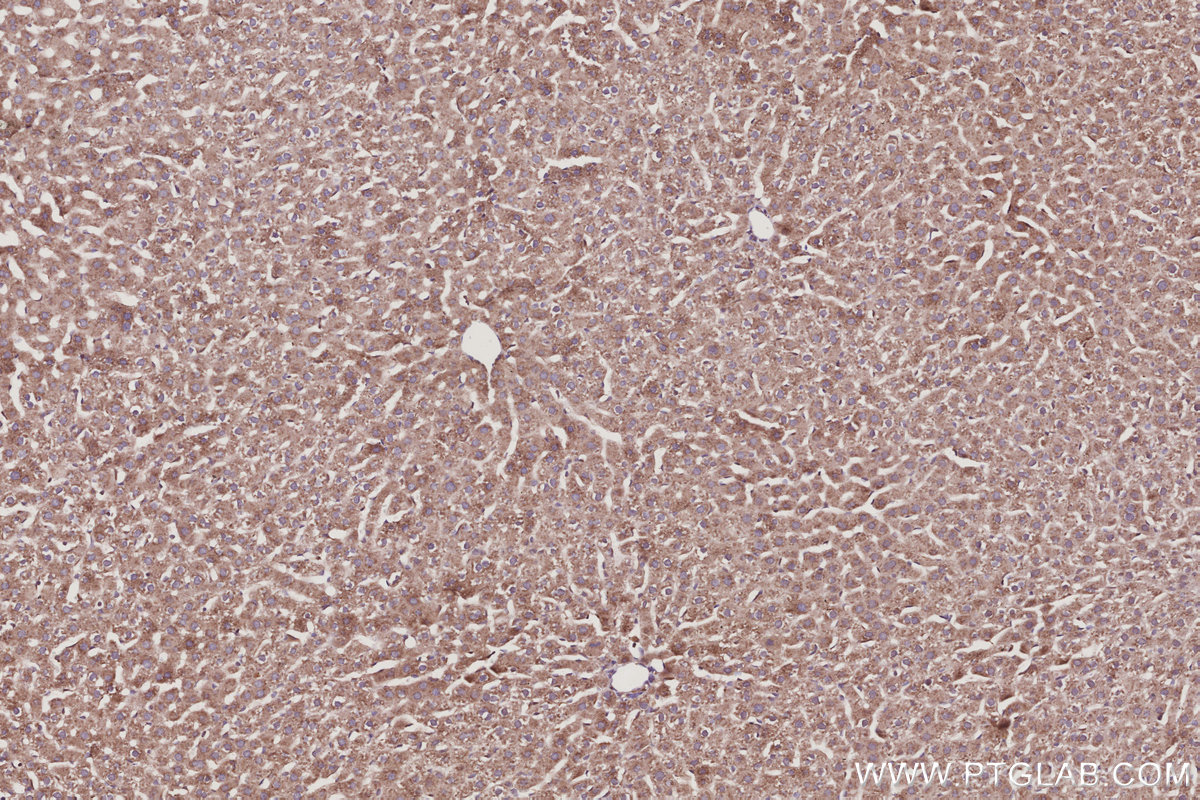 Immunohistochemical analysis of paraffin-embedded rat liver tissue slide using KHC3015 (RABGEF1 IHC Kit). Immunohistochemical analysis of paraffin-embedded rat liver tissue slide using KHC3015 (RABGEF1 IHC Kit).