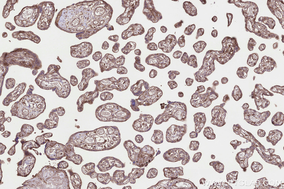 Immunohistochemical analysis of paraffin-embedded human placenta tissue slide using KHC3307 (RABGGTA IHC Kit).