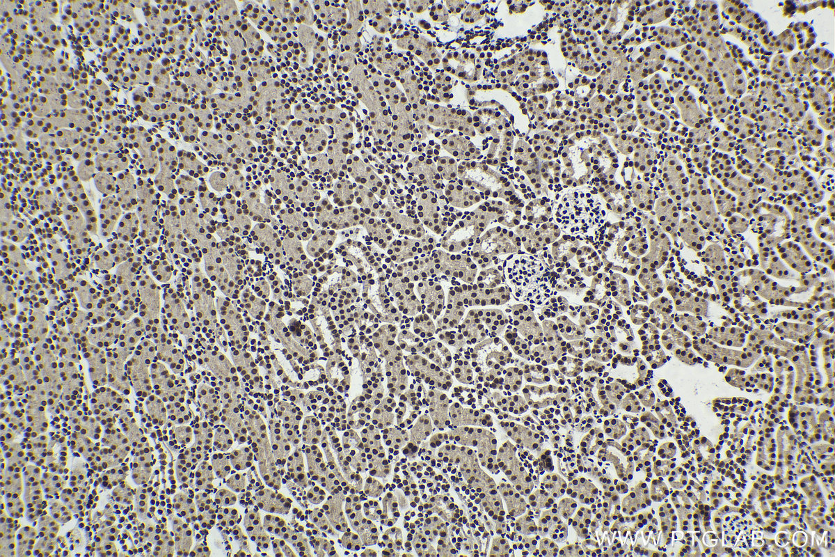 Immunohistochemical analysis of paraffin-embedded mouse kidney tissue slide using KHC2094 (RAD21 IHC Kit).