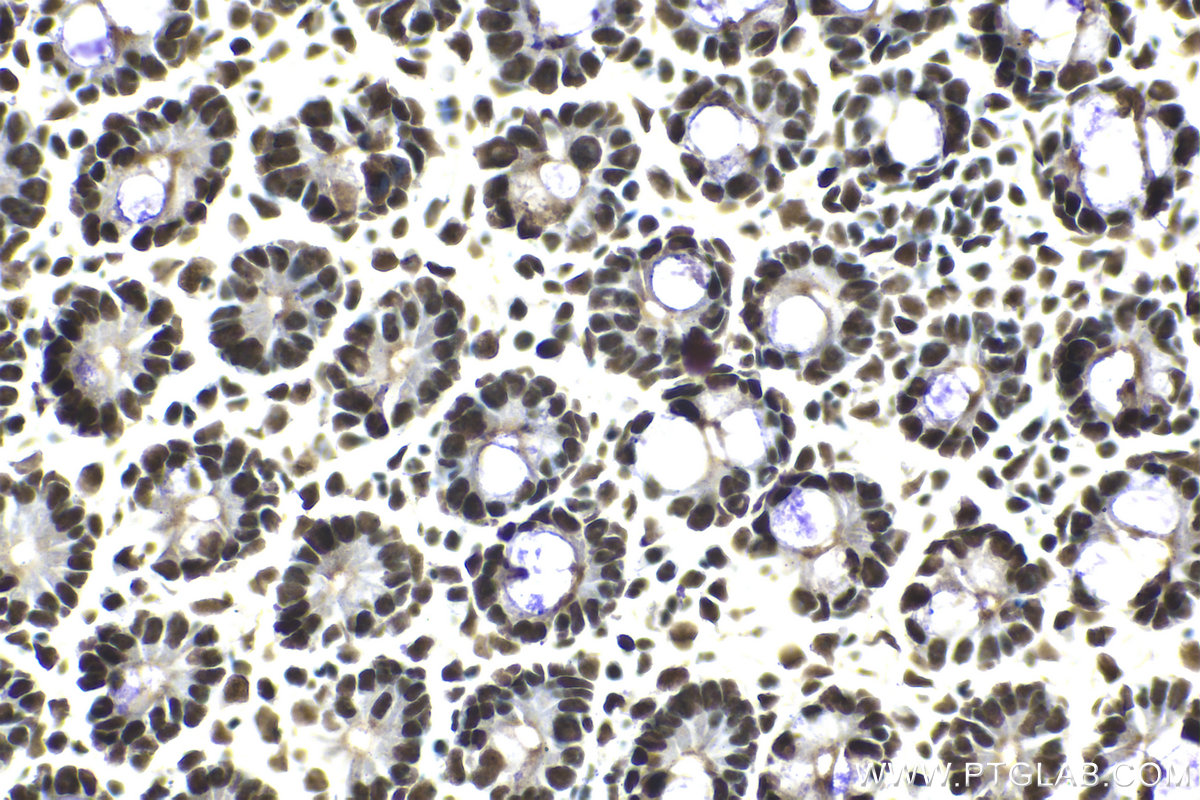 Immunohistochemical analysis of paraffin-embedded mouse intestine tissue slide using KHC2094 (RAD21 IHC Kit).