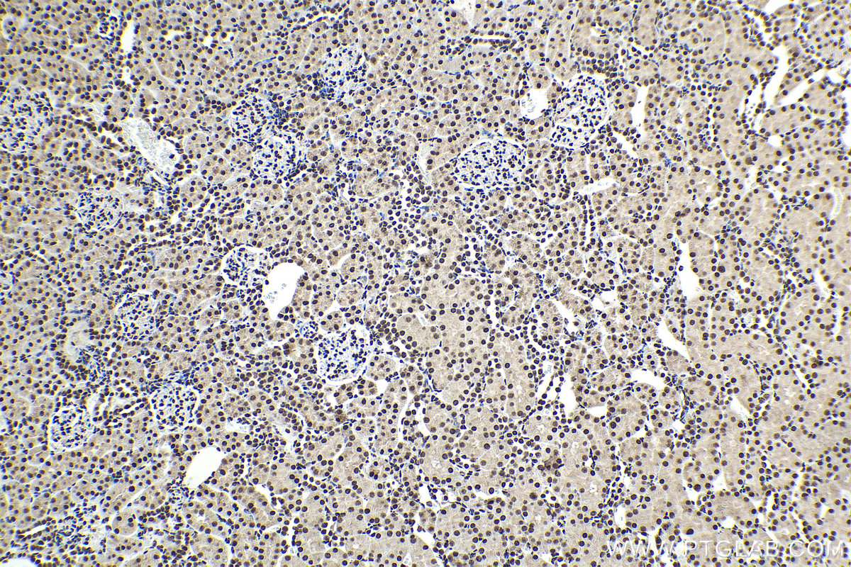 Immunohistochemical analysis of paraffin-embedded rat kidney tissue slide using KHC2094 (RAD21 IHC Kit).