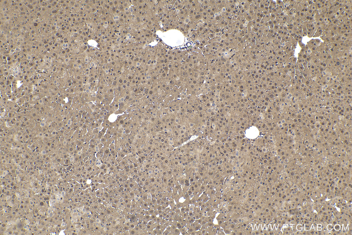 Immunohistochemical analysis of paraffin-embedded mouse liver tissue slide using KHC1629 (RAD23B IHC Kit).