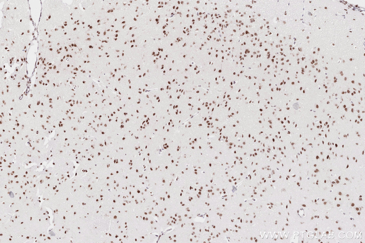 Immunohistochemical analysis of paraffin-embedded mouse brain tissue slide using KHC2763 (RAD50 IHC Kit).