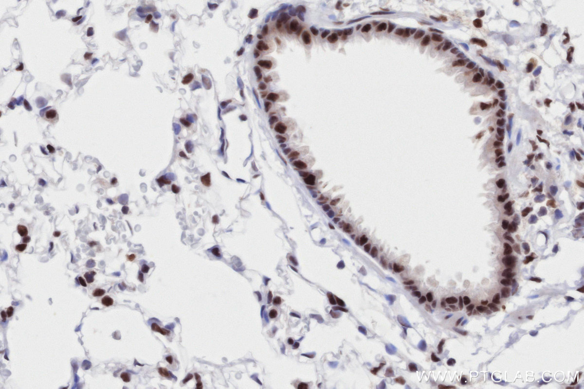 Immunohistochemical analysis of paraffin-embedded rat lung tissue slide using KHC2763 (RAD50 IHC Kit).