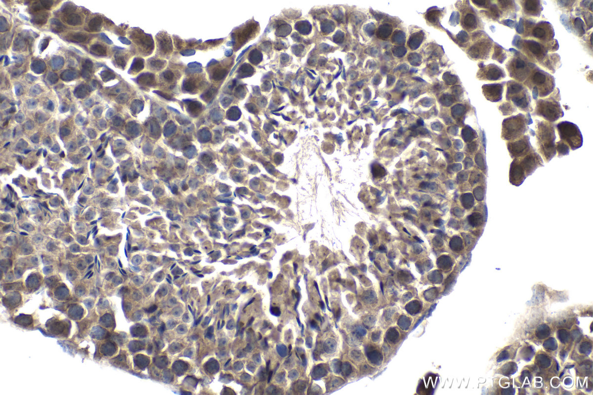 Immunohistochemical analysis of paraffin-embedded mouse testis tissue slide using KHC0965 (RAE1 IHC Kit).