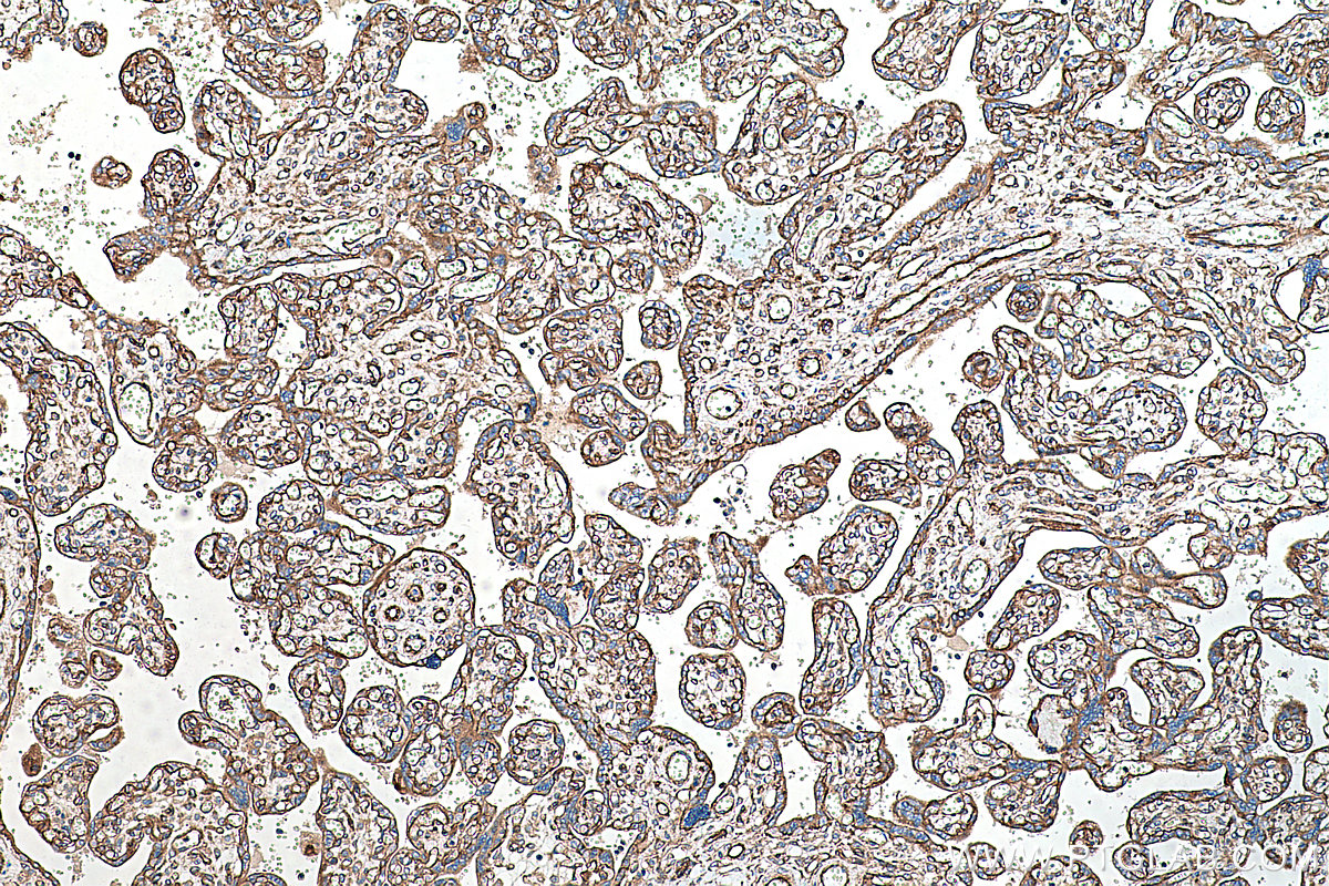 Immunohistochemical analysis of paraffin-embedded human placenta tissue slide using KHC0271 (RALB IHC Kit).
