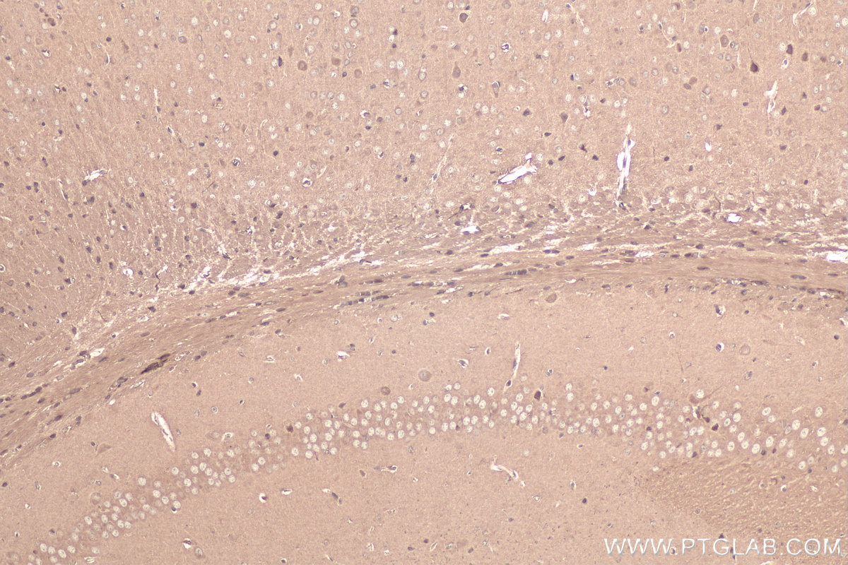 Immunohistochemical analysis of paraffin-embedded mouse brain tissue slide using KHC0881 (RANBP1 IHC Kit).