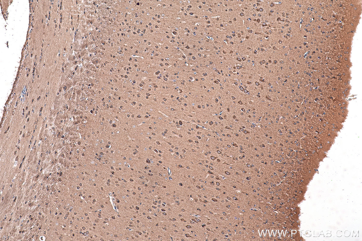 Immunohistochemical analysis of paraffin-embedded mouse brain tissue slide using KHC0922 (RAP1GDS1 IHC Kit).