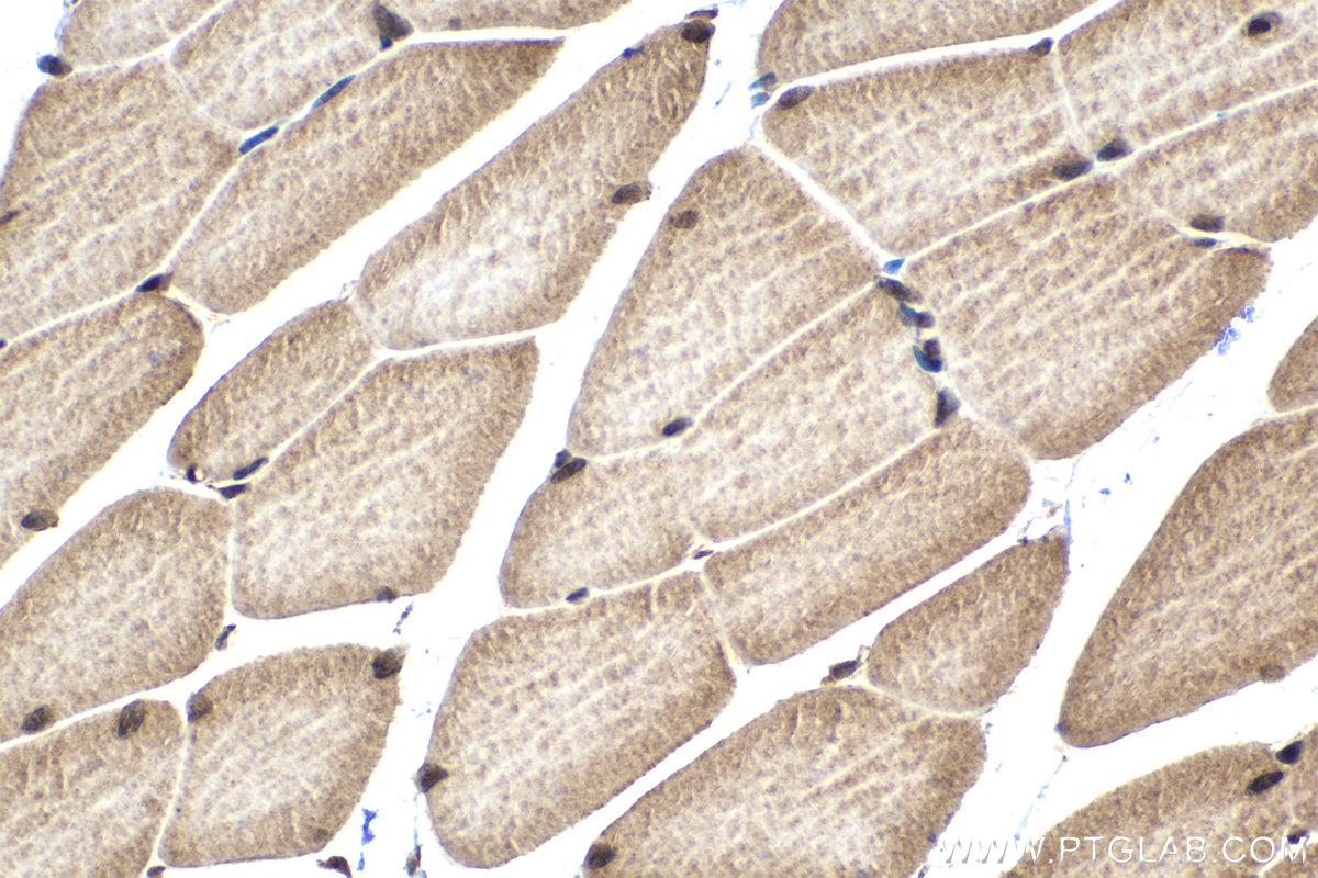 Immunohistochemical analysis of paraffin-embedded mouse skeletal muscle tissue slide using KHC1521 (RARA IHC Kit).