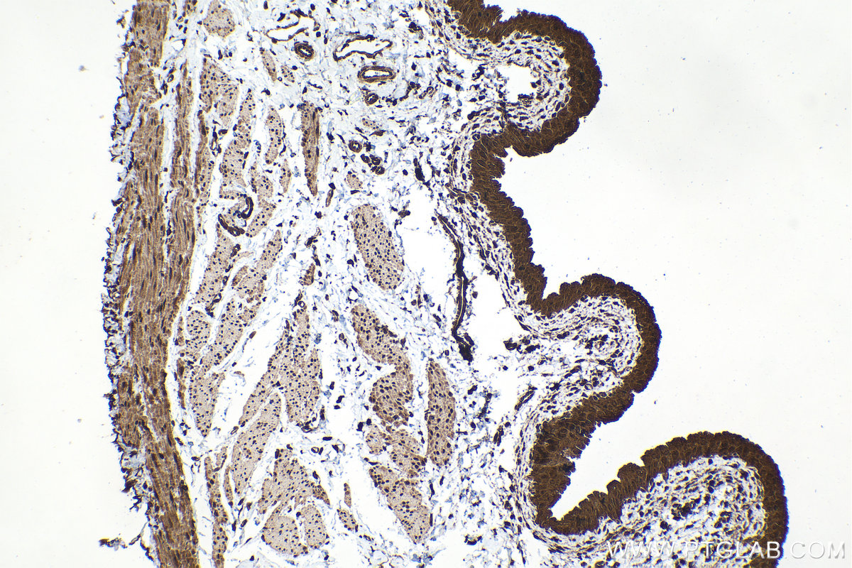 Immunohistochemical analysis of paraffin-embedded rat bladder tissue slide using KHC1522 (RARB IHC Kit).