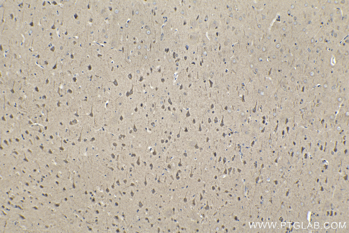 Immunohistochemical analysis of paraffin-embedded rat brain tissue slide using KHC1522 (RARB IHC Kit).