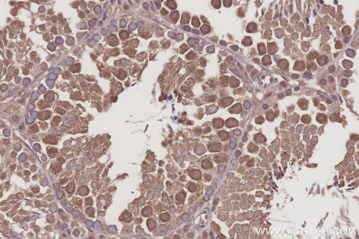 Immunohistochemical analysis of paraffin-embedded mouse testis tissue slide using KHC3026 (RASAL2 IHC Kit).