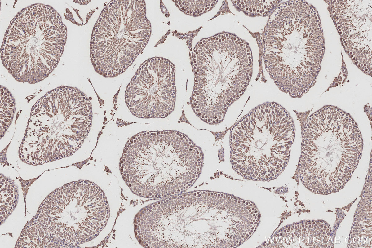 Immunohistochemical analysis of paraffin-embedded rat testis tissue slide using KHC3026 (RASAL2 IHC Kit).