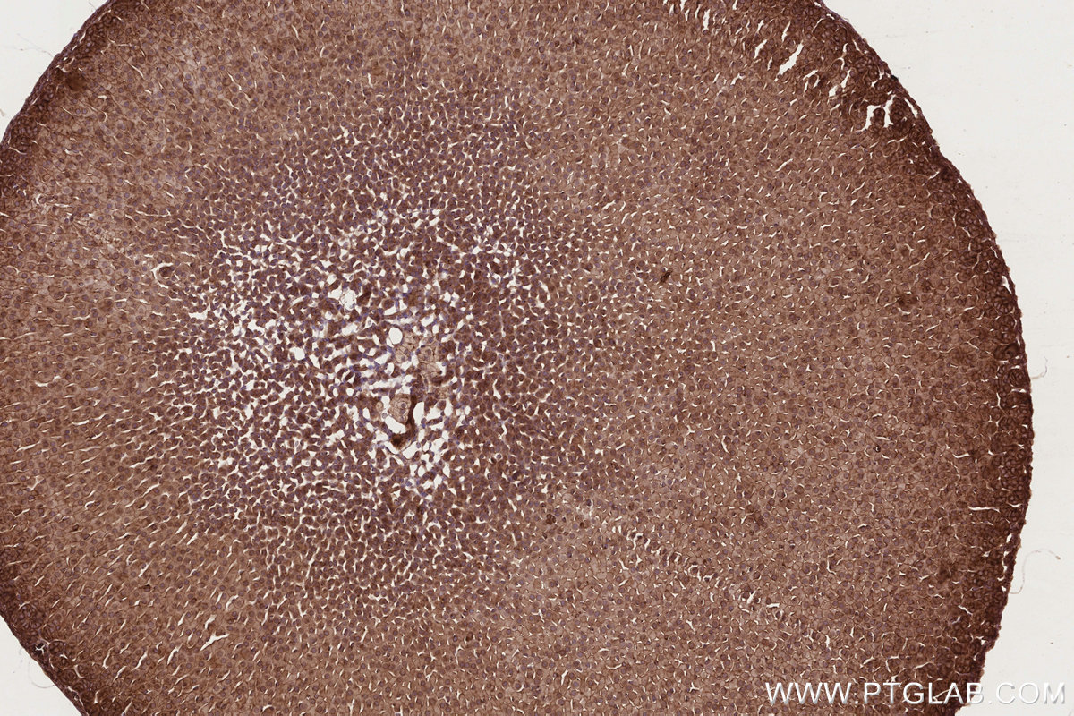 Immunohistochemical analysis of paraffin-embedded mouse adrenal gland tissue slide using KHC2721 (RB1CC1 IHC Kit).