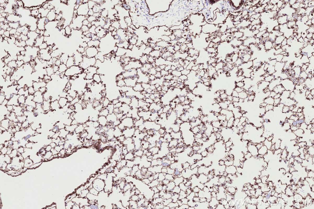 Immunohistochemical analysis of paraffin-embedded mouse lung tissue slide using KHC2721 (RB1CC1 IHC Kit).