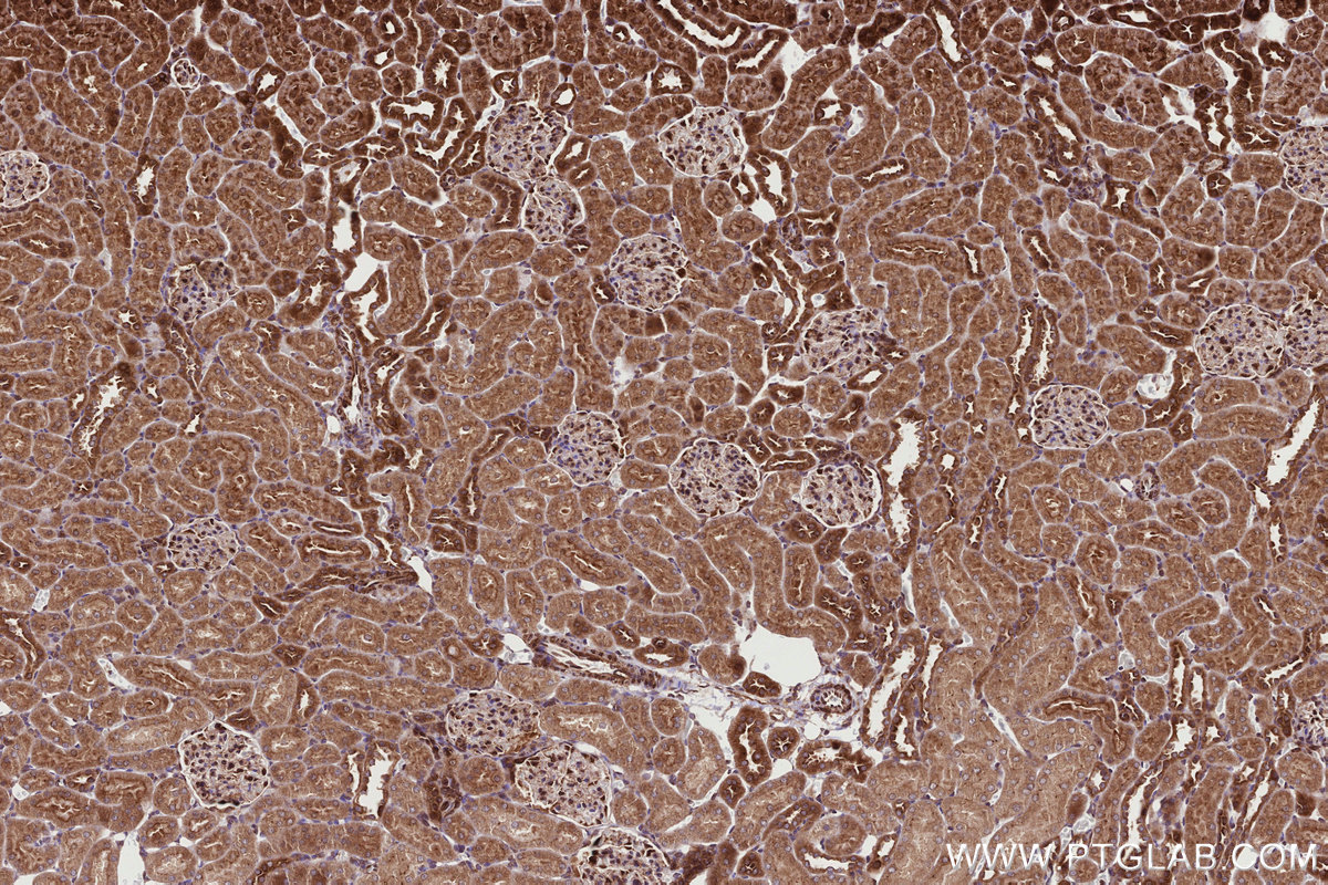 Immunohistochemical analysis of paraffin-embedded rat kidney tissue slide using KHC2721 (RB1CC1 IHC Kit).
