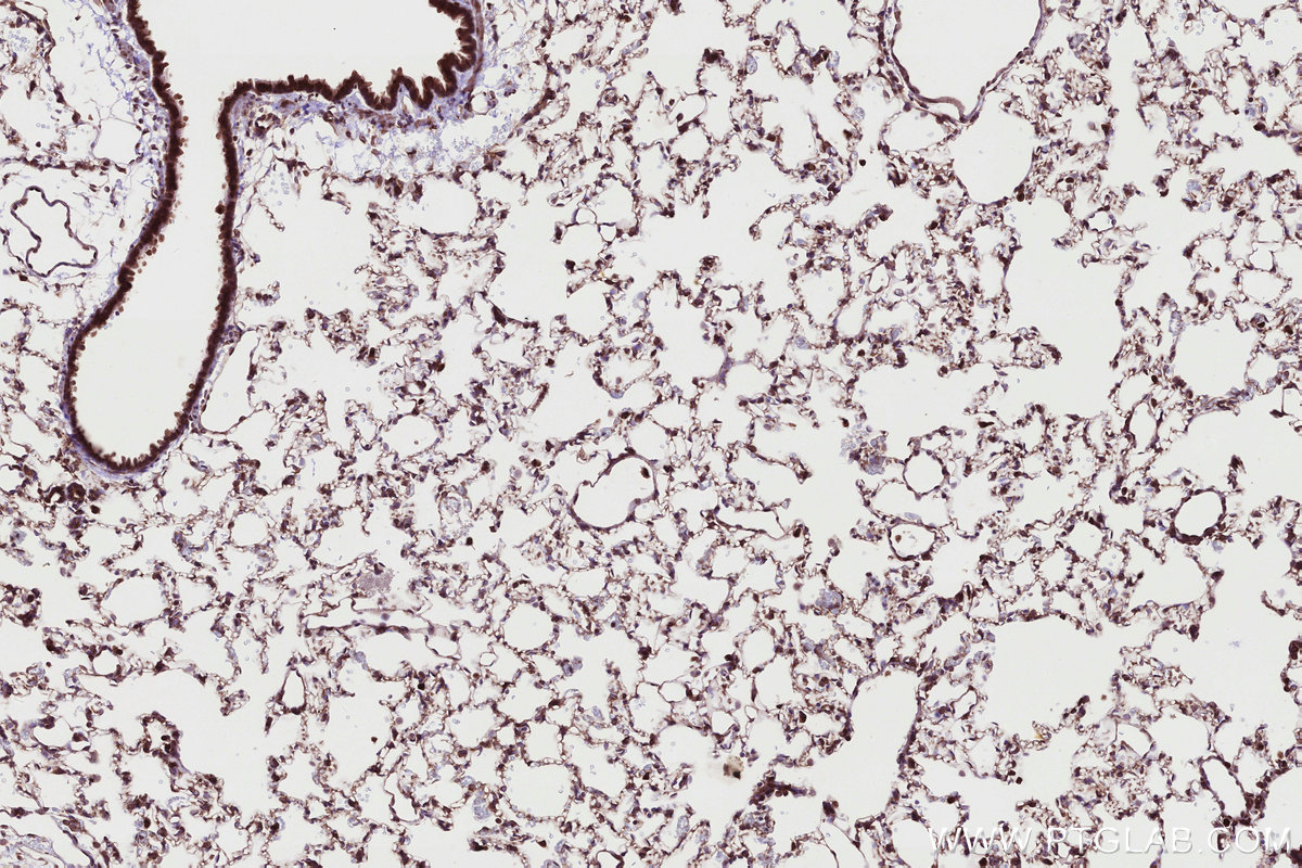 Immunohistochemical analysis of paraffin-embedded rat lung tissue slide using KHC2721 (RB1CC1 IHC Kit).