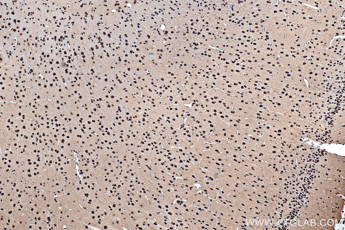 Immunohistochemical analysis of paraffin-embedded rat brain tissue slide using KHC0918 (RBBP4 IHC Kit).